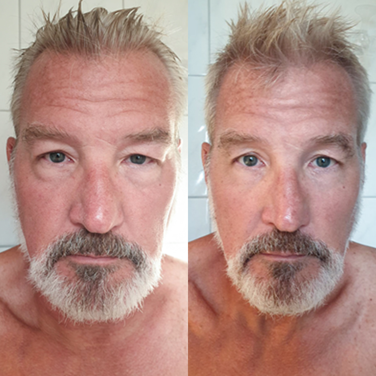 Before & After 1