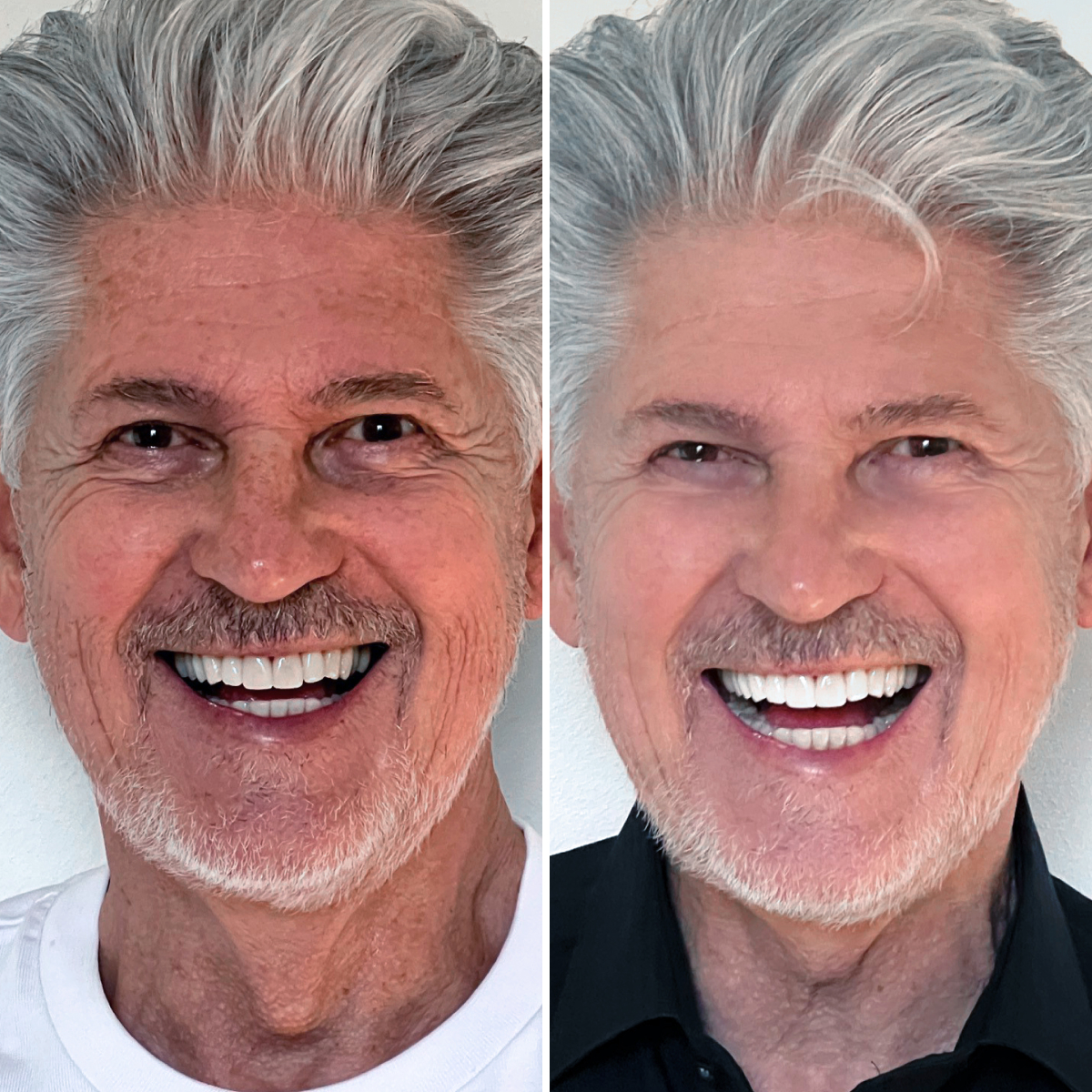 Before & After 3