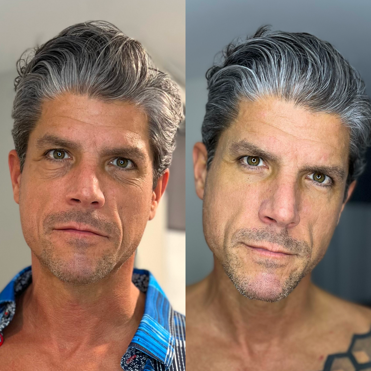 Before and after using Particle Face Cream on the under-eye area