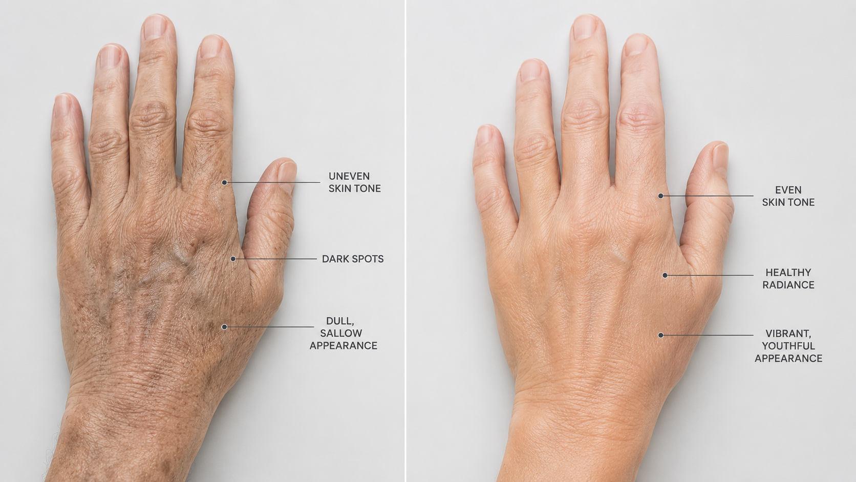 Dull uneven skin tone on men's hands